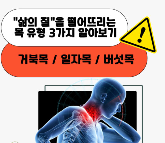 자꾸 일어나는 목 통증 | 일자목,거북목,버섯목이다?